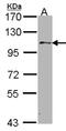 Ubiquitin Specific Peptidase 10 antibody, NBP1-33677, Novus Biologicals, Western Blot image 