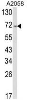 Activating Transcription Factor 6 antibody, AP17892PU-N, Origene, Western Blot image 