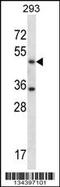 Serine Hydroxymethyltransferase 1 antibody, 57-723, ProSci, Western Blot image 