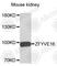 Zinc Finger FYVE-Type Containing 16 antibody, A7766, ABclonal Technology, Western Blot image 