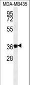 Exonuclease 5 antibody, LS-C167355, Lifespan Biosciences, Western Blot image 