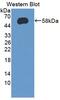 UDP-glucuronosyltransferase 2B7 antibody, abx131670, Abbexa, Western Blot image 