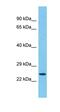 Transmembrane P24 Trafficking Protein 5 antibody, orb327117, Biorbyt, Western Blot image 