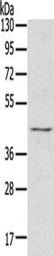 HRC1 antibody, CSB-PA447601, Cusabio, Western Blot image 