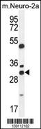 ARV1 Homolog, Fatty Acid Homeostasis Modulator antibody, 55-316, ProSci, Western Blot image 