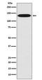 Integrin Subunit Beta 1 antibody, M00772-1, Boster Biological Technology, Western Blot image 