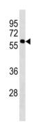 KISS1 Receptor antibody, abx034653, Abbexa, Western Blot image 