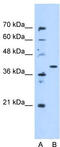 Enoyl-CoA Hydratase Domain Containing 3 antibody, TA346830, Origene, Western Blot image 