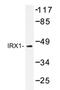 Iroquois Homeobox 1 antibody, AP20429PU-N, Origene, Western Blot image 