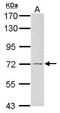 Growth Factor Receptor Bound Protein 10 antibody, GTX125982, GeneTex, Western Blot image 