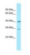 DnaJ Heat Shock Protein Family (Hsp40) Member C11 antibody, NBP1-98430, Novus Biologicals, Western Blot image 