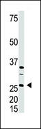 Dickkopf WNT Signaling Pathway Inhibitor 4 antibody, 58-170, ProSci, Western Blot image 