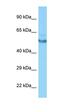 Calcium/Calmodulin Dependent Protein Kinase II Gamma antibody, orb331203, Biorbyt, Western Blot image 