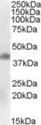 Apolipoprotein B MRNA Editing Enzyme Catalytic Subunit 1 antibody, 46-761, ProSci, Enzyme Linked Immunosorbent Assay image 