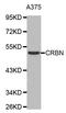 Cereblon antibody, orb373257, Biorbyt, Western Blot image 