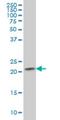 RAB2B, Member RAS Oncogene Family antibody, H00084932-M02, Novus Biologicals, Western Blot image 