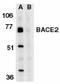 Beta-Secretase 2 antibody, LS-B3764, Lifespan Biosciences, Western Blot image 