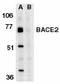 Beta-secretase 2 antibody, LS-B3764, Lifespan Biosciences, Western Blot image 