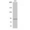 Signal Transducer And Activator Of Transcription 5A antibody, LS-C386213, Lifespan Biosciences, Western Blot image 