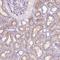 Matrix Metallopeptidase 11 antibody, NBP2-49575, Novus Biologicals, Immunohistochemistry paraffin image 