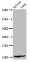 S100 Calcium Binding Protein A8 antibody, LS-C370287, Lifespan Biosciences, Western Blot image 