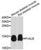 PVA antibody, A13538, ABclonal Technology, Western Blot image 