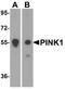 Serine/threonine-protein kinase PINK1, mitochondrial antibody, A00201, Boster Biological Technology, Western Blot image 