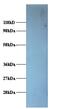 Proteasome 26S Subunit, Non-ATPase 11 antibody, MBS715197, MyBioSource, Western Blot image 