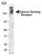 Calcium Sensing Receptor antibody, MA1-16940, Invitrogen Antibodies, Western Blot image 