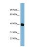 NADP Dependent Oxidoreductase Domain Containing 1 antibody, NBP1-70434, Novus Biologicals, Western Blot image 