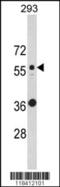 Keratin 10 antibody, MBS9212551, MyBioSource, Western Blot image 