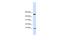 ATP Synthase Inhibitory Factor Subunit 1 antibody, A06408, Boster Biological Technology, Western Blot image 