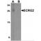 Serine Peptidase Inhibitor, Kazal Type 7 (Putative) antibody, MBS151465, MyBioSource, Western Blot image 