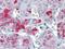 Perilipin 3 antibody, AP08870PU-N, Origene, Immunohistochemistry frozen image 