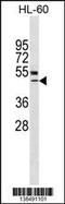 Vitamin D Receptor antibody, 59-872, ProSci, Western Blot image 