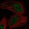 Oxidoreductase NAD Binding Domain Containing 1 antibody, PA5-65180, Invitrogen Antibodies, Immunofluorescence image 