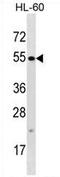 Tetratricopeptide Repeat Domain 34 antibody, AP54397PU-N, Origene, Western Blot image 