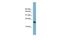 Basic Leucine Zipper ATF-Like Transcription Factor 3 antibody, GTX44669, GeneTex, Western Blot image 