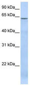 TBC1 Domain Family Member 22A antibody, TA334521, Origene, Western Blot image 