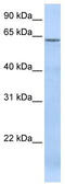 TBC1 Domain Family Member 22A antibody, TA334521, Origene, Western Blot image 