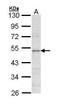 Lipoprotein Lipase antibody, PA5-34812, Invitrogen Antibodies, Western Blot image 