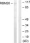 RNA Binding Motif Protein 26 antibody, abx013654, Abbexa, Western Blot image 