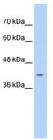 Calcium Voltage-Gated Channel Auxiliary Subunit Beta 2 antibody, TA339047, Origene, Western Blot image 