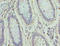 Zinc Finger Protein 555 antibody, A63940-100, Epigentek, Immunohistochemistry paraffin image 