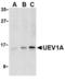 Ubiquitin Conjugating Enzyme E2 V1 antibody, LS-C451, Lifespan Biosciences, Western Blot image 
