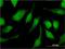 Tripartite Motif Containing 47 antibody, H00091107-M02, Novus Biologicals, Immunocytochemistry image 