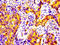 Matrilin 2 antibody, LS-C672031, Lifespan Biosciences, Immunohistochemistry paraffin image 
