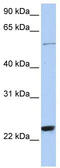 Zinc Finger Protein 83 antibody, TA339507, Origene, Western Blot image 