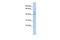 Spermatogenesis And Centriole Associated 1 antibody, GTX45157, GeneTex, Western Blot image 