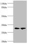 Acyl-CoA Binding Domain Containing 4 antibody, CSB-PA818758LA01HU, Cusabio, Western Blot image 